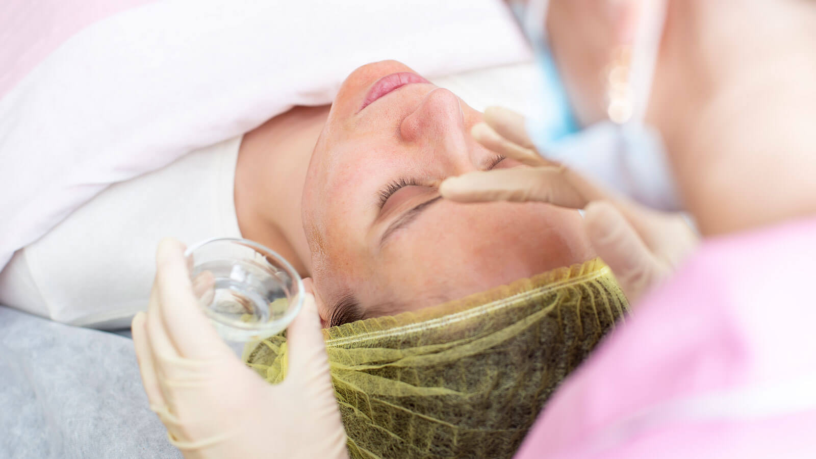 qué es el melasma
