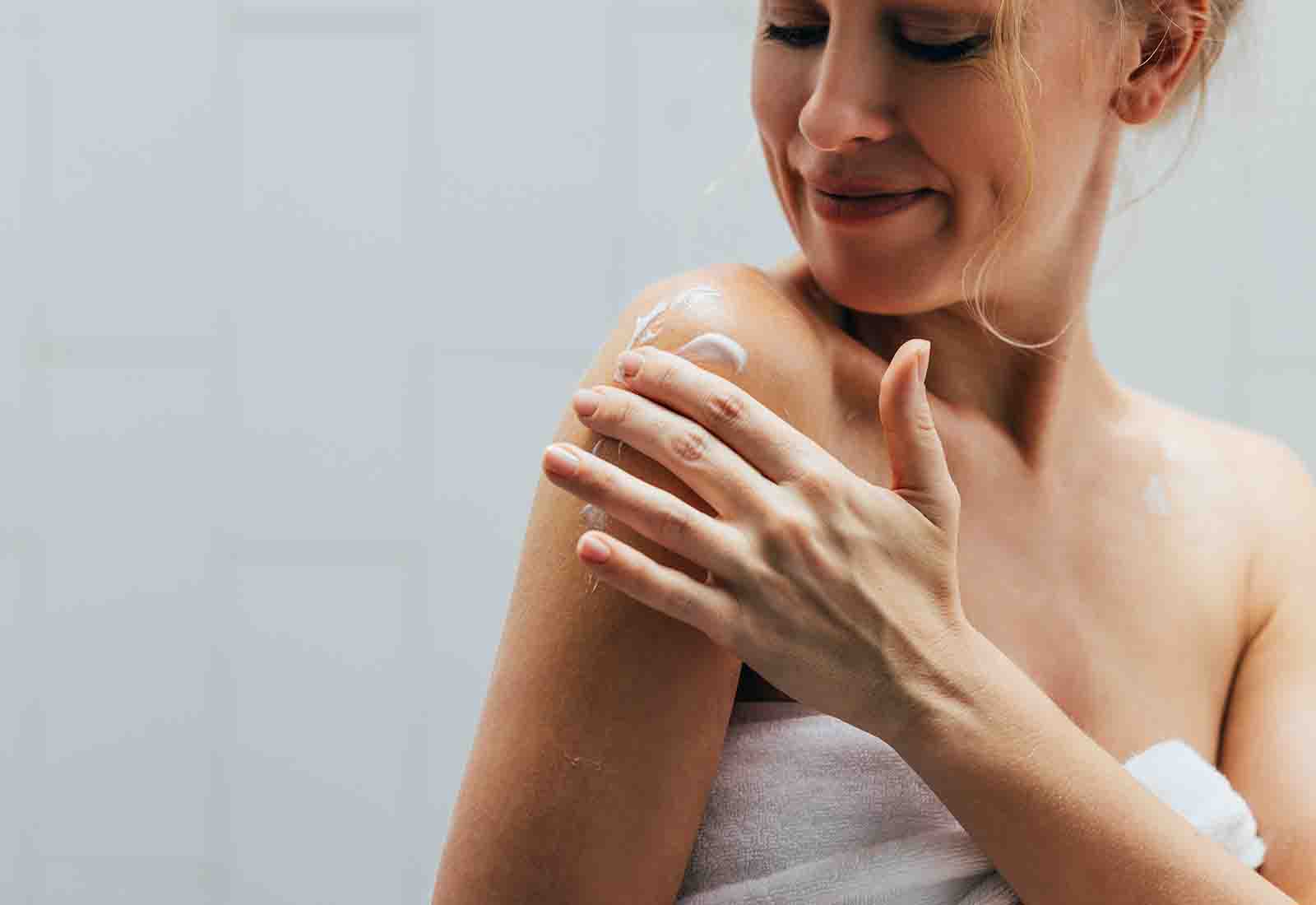 dermatitis solar