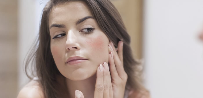 como tratar la rosacea