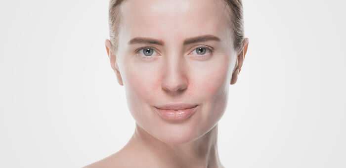 dermatitis atopica en la cara