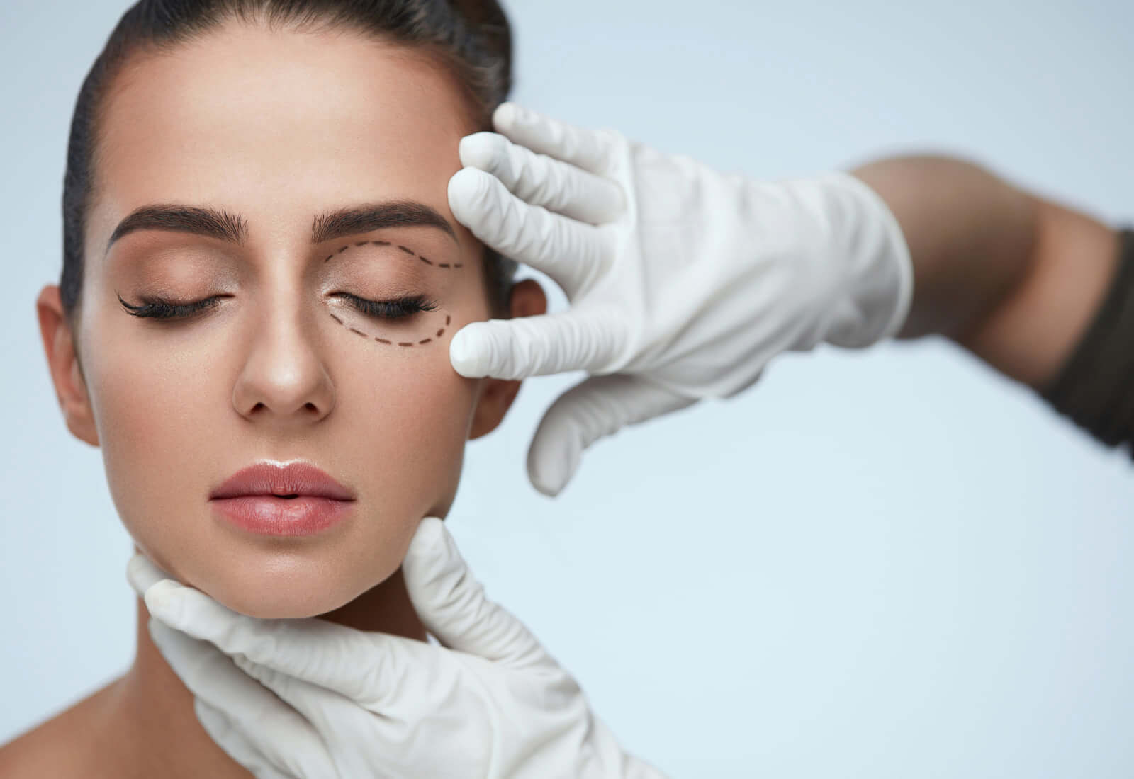 Blefaroplastia cirugía plástica
