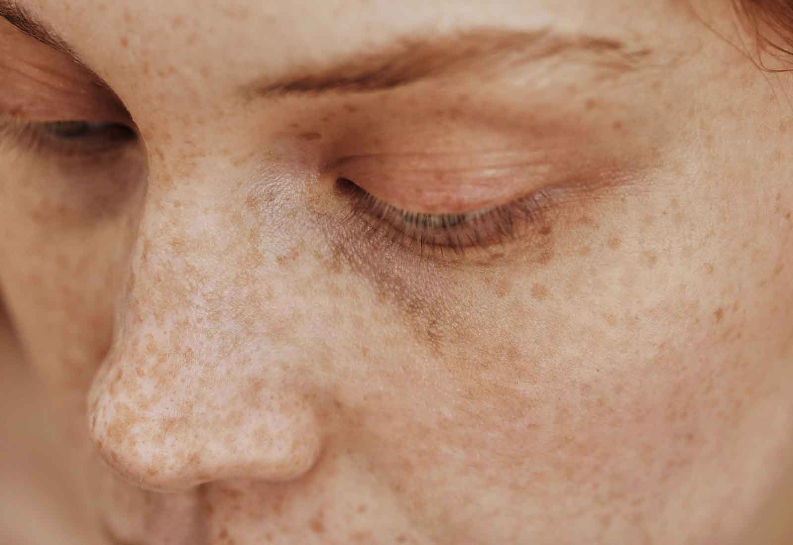 por que salen pecas nuevas