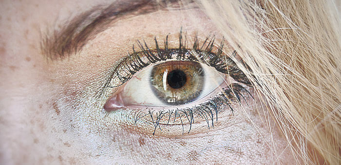 por-que-salen-pecas