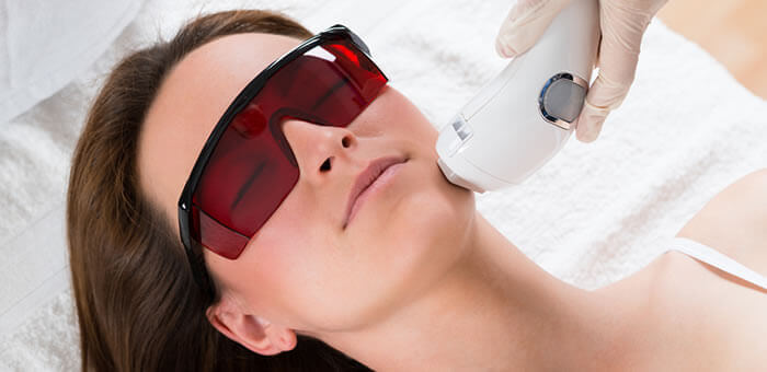 depilacion laser facial efecto paradojico