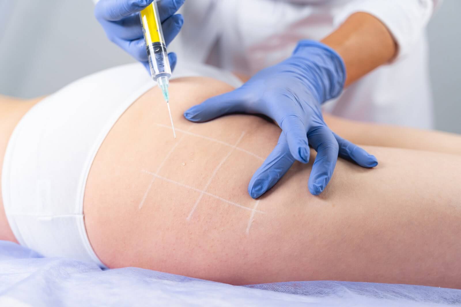 cartucheras mesoterapia