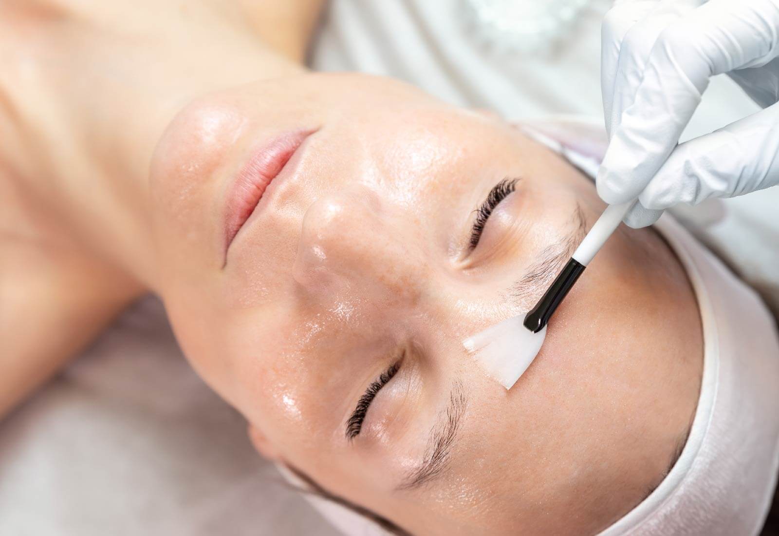 Tipos de peeling facial