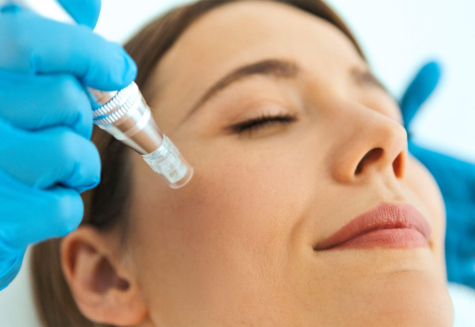 ¿Para que sirve la mesoterapia facial?